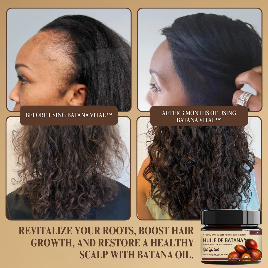 Batana Vital™ | Stimulates Growth, Thicker Hair in 28 Days