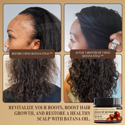 Batana Vital™ | Stimulates Growth, Thicker Hair in 28 Days