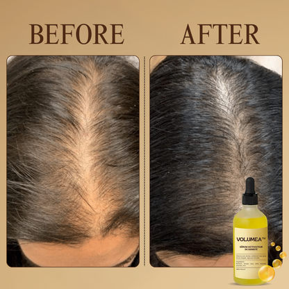 Volumea™ Serum | Stops Hair Loss, Restores Density in 28 Days
