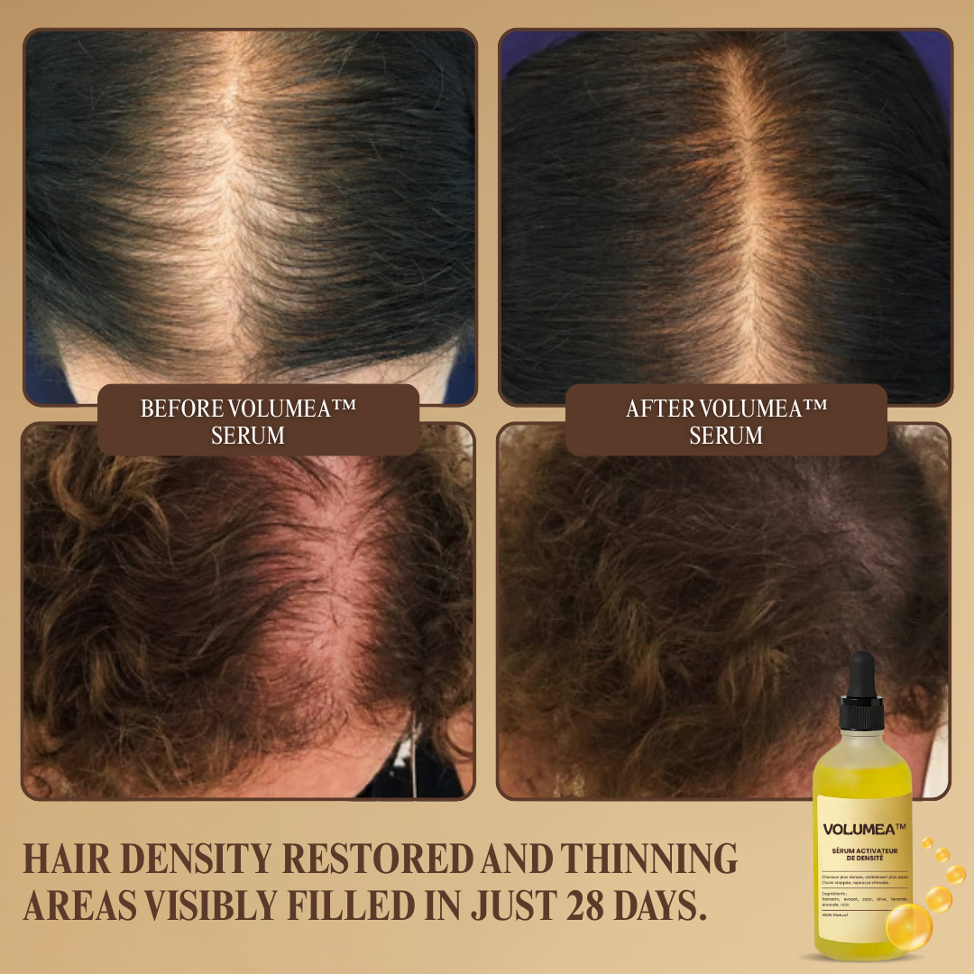 Volumea™ Serum | Stops Hair Loss, Restores Density in 28 Days