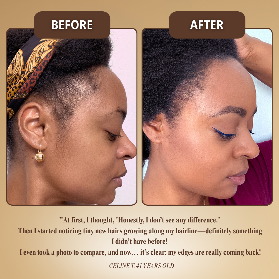 Batana Vital™ | Stimulates Growth, Thicker Hair in 28 Days